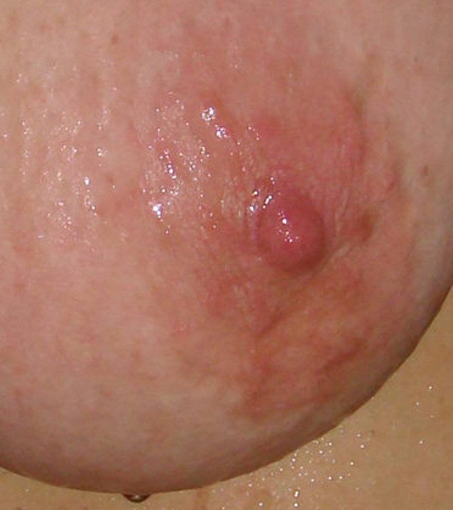 35HR2 Rose from Indiana, BBW Spreads #z6QljXsy