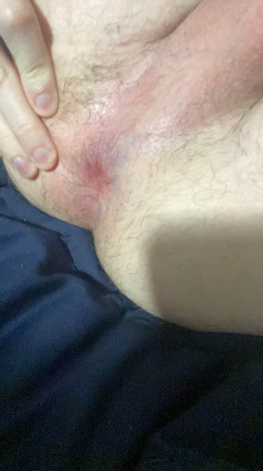 Look at this slave sissy fag kik in recent post #XD99fB5z