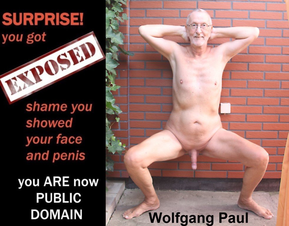 Nackedei - Wolfgang Paul #vtz3Em5r